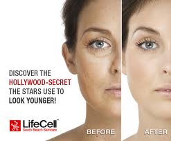 Lifecell antiaging skin cream review
